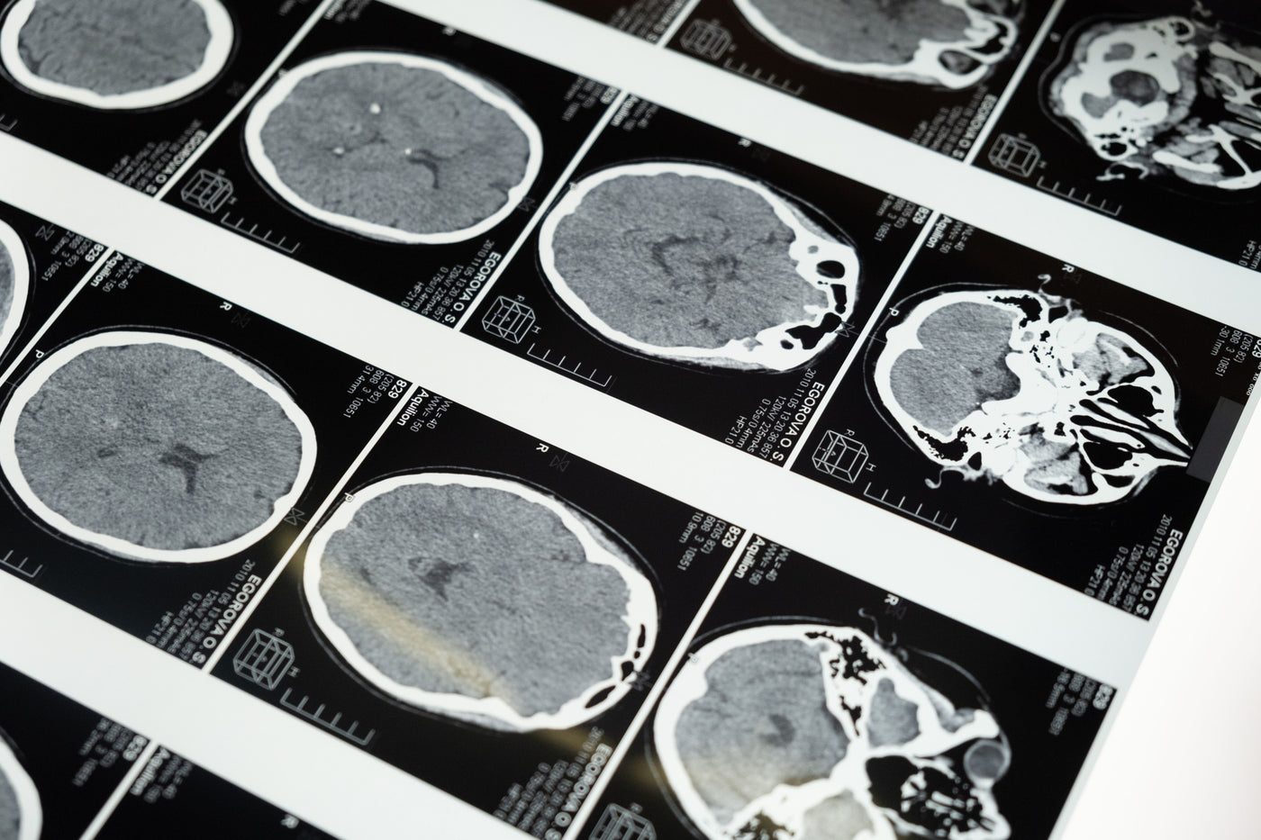 A grid of PET scan brain images